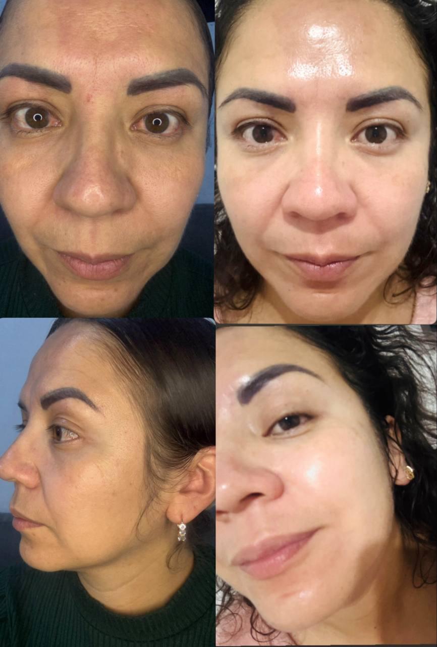 Laura, 38 · Medellín